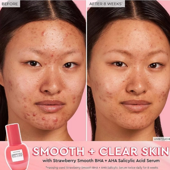 Glow Recipe Fruit Babies Mini Set - Pink & Green - Picture 5 of 5